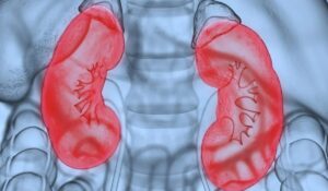 kidney Diseases: नेफ्रोटिक सिंड्रोम से जुड़ी बीमारियों का पता लगाने में बड़ी प्रगति