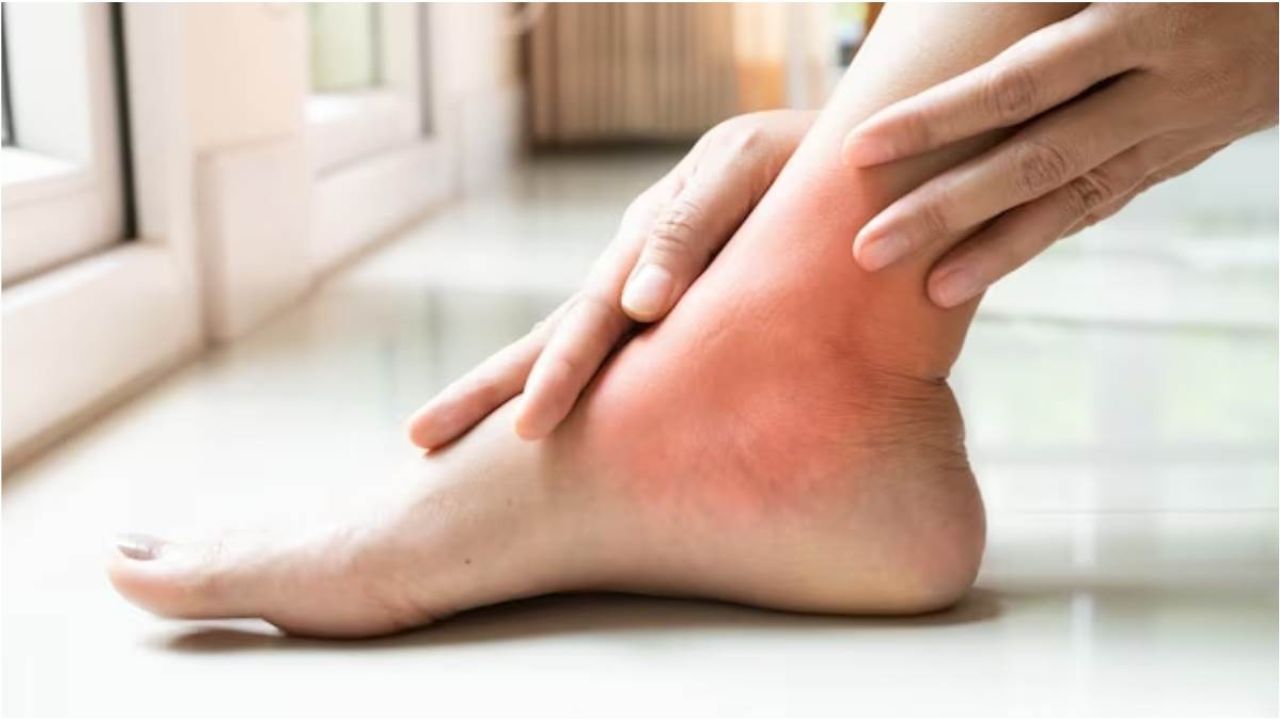 Swollen Feet: हाथों और पैरों में सूजन है तो हो जाएं सावधान, ये हैं इस बीमारी के लक्षण