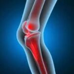 Osteoarthritis और रूमेटॉइड आर्थराइटिस, जानें दोनों के इलाज में अंतर!