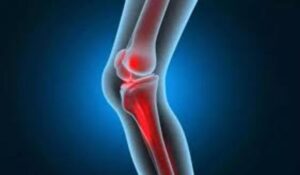 Osteoarthritis और रूमेटॉइड आर्थराइटिस, जानें दोनों के इलाज में अंतर!