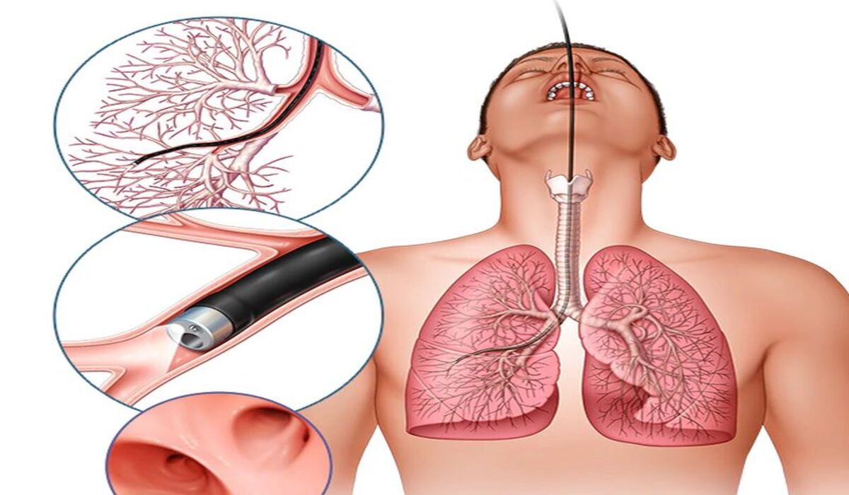 Lung Tumor Symptoms : फेफड़ों में ट्यूमर के संकेत, क्या आप भी इन्हें नजरअंदाज कर रहे हैं?